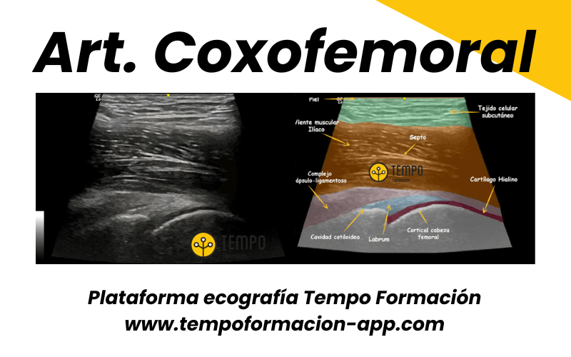 2.  Ecografia Tempo Formacion Articulacion Coxofemoral.png